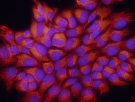 S100A8 Antibody in Immunocytochemistry (ICC/IF)