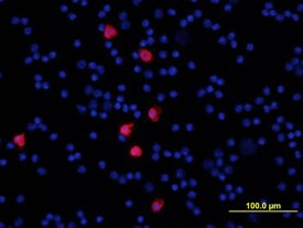 S100A8 Antibody in Immunocytochemistry (ICC/IF)