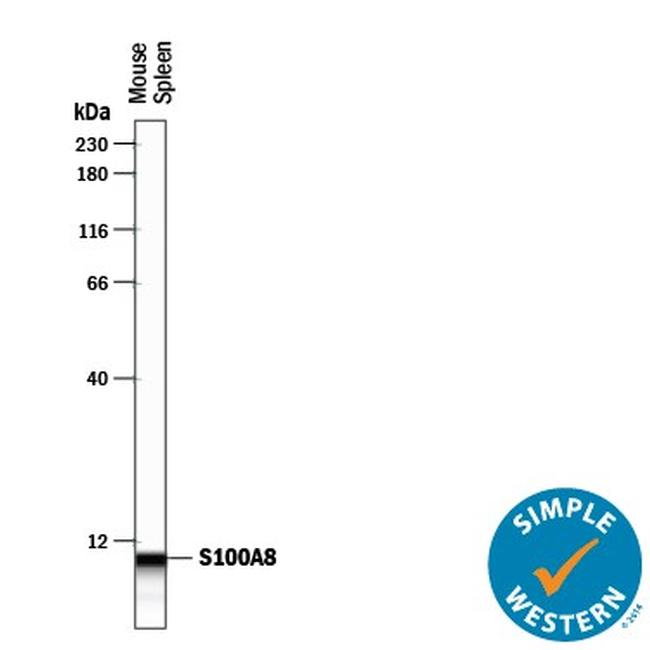 S100A8 Antibody in Western Blot (WB)