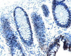 A33 Antibody in Immunohistochemistry (Paraffin) (IHC (P))