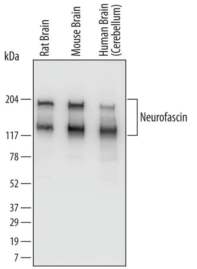 Neurofascin Antibody in Western Blot (WB)