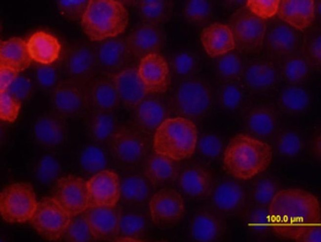 H-cadherin Antibody in Immunocytochemistry (ICC/IF)