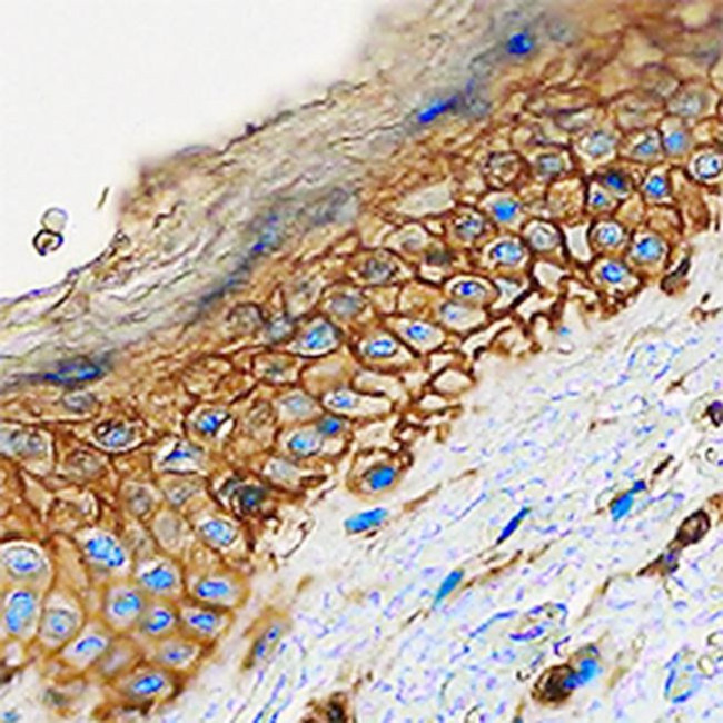 H-cadherin Antibody in Immunohistochemistry (Paraffin) (IHC (P))