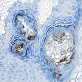 GLI1 Antibody in Immunohistochemistry (Paraffin) (IHC (P))