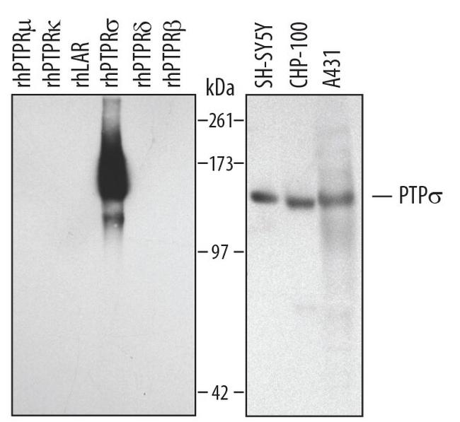 PTPRS Antibody in Western Blot (WB)