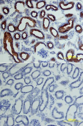 ACE2 Antibody in Immunohistochemistry (Frozen) (IHC (F))