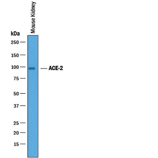 ACE2 Antibody in Western Blot (WB)