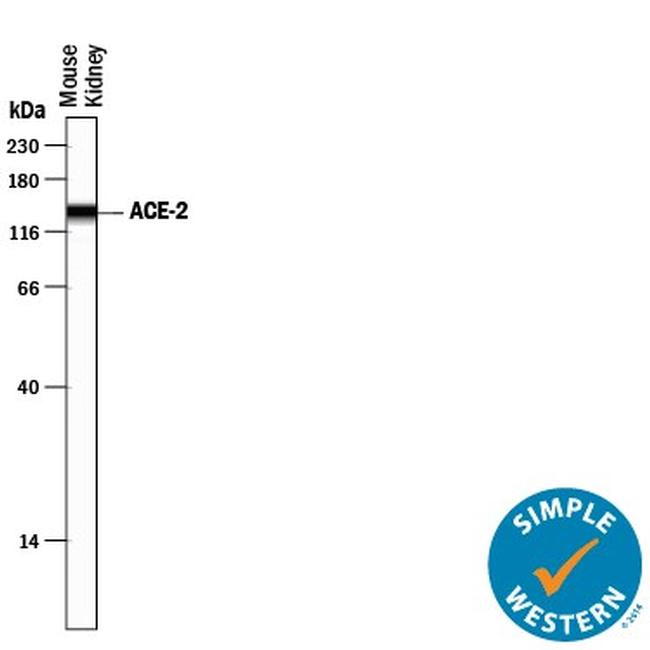 ACE2 Antibody in Western Blot (WB)