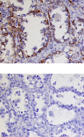 Kallikrein 9 Antibody in Immunohistochemistry (Paraffin) (IHC (P))