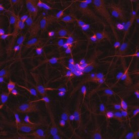 Nogo-A Antibody in Immunocytochemistry (ICC/IF)