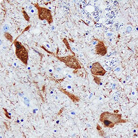 DOPA Decarboxylase Antibody in Immunohistochemistry (Paraffin) (IHC (P))