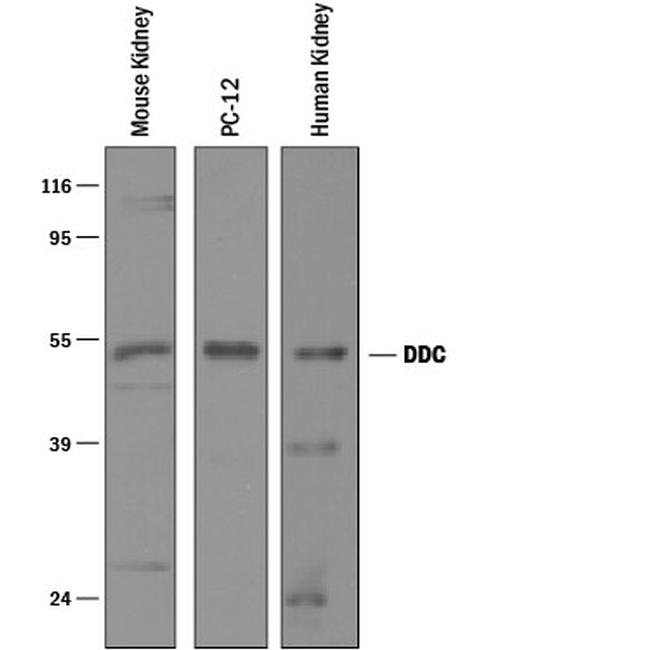 DOPA Decarboxylase Antibody in Western Blot (WB)