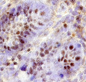 FKBP8 Antibody in Immunohistochemistry (Paraffin) (IHC (P))