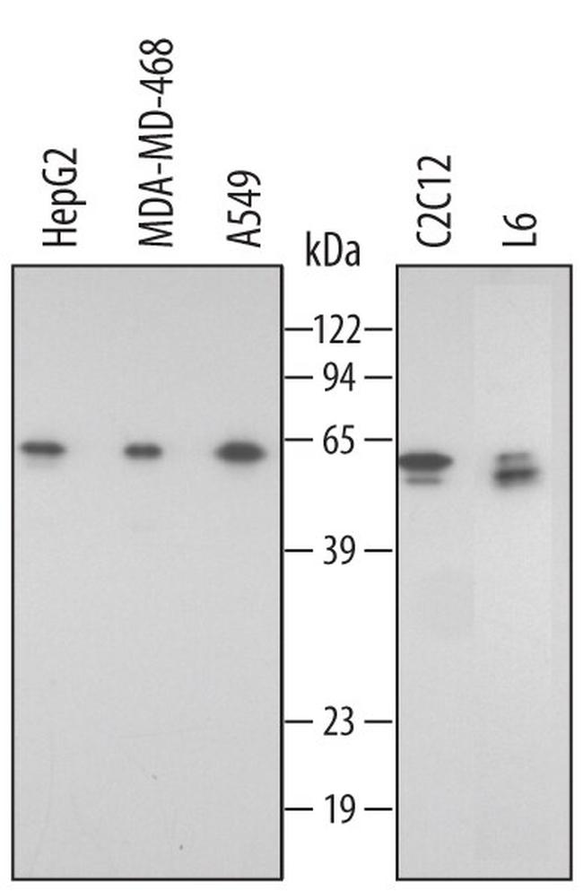 FKBP8 Antibody in Western Blot (WB)