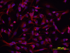 DSCAM Antibody in Immunocytochemistry (ICC/IF)