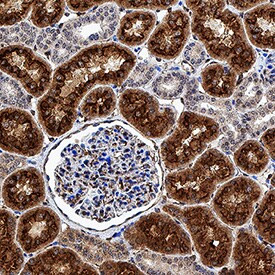 CUBN Antibody in Immunohistochemistry (Paraffin) (IHC (P))