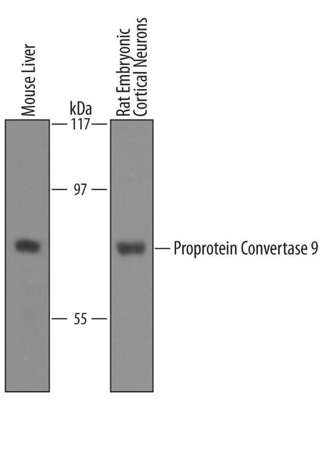 PCSK9 Antibody in Western Blot (WB)