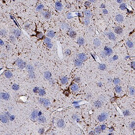 PLXNA3 Antibody in Immunohistochemistry (Paraffin) (IHC (P))