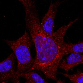 ITGA8 Antibody in Immunocytochemistry (ICC/IF)