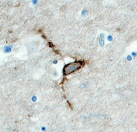 HAPLN4 Antibody in Immunohistochemistry (Paraffin) (IHC (P))