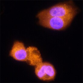 IDUA Antibody in Immunocytochemistry (ICC/IF)