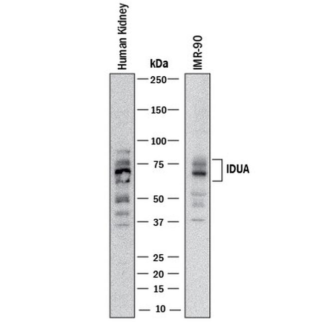 IDUA Antibody in Western Blot (WB)