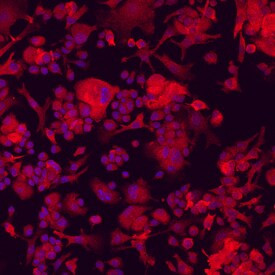 Plexin-A1 Antibody in Immunocytochemistry (ICC/IF)