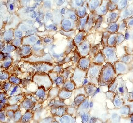 CD109 Antibody in Immunohistochemistry (Paraffin) (IHC (P))