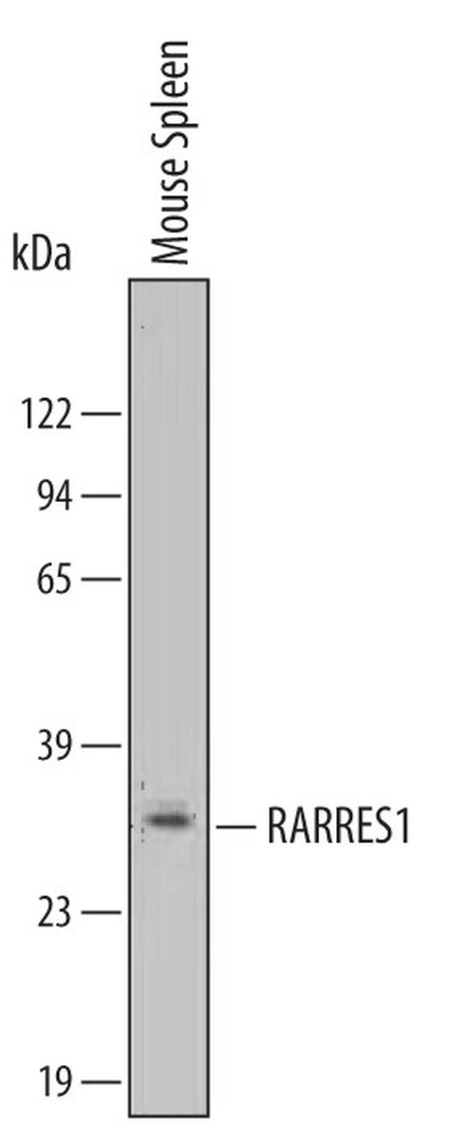 RARRES1 Antibody in Western Blot (WB)