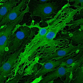 Endomucin Antibody in Immunocytochemistry (ICC/IF)