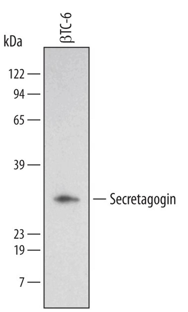 SCGN Antibody in Western Blot (WB)