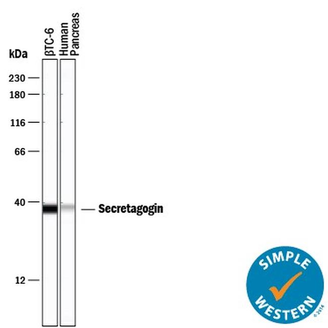 SCGN Antibody in Western Blot (WB)