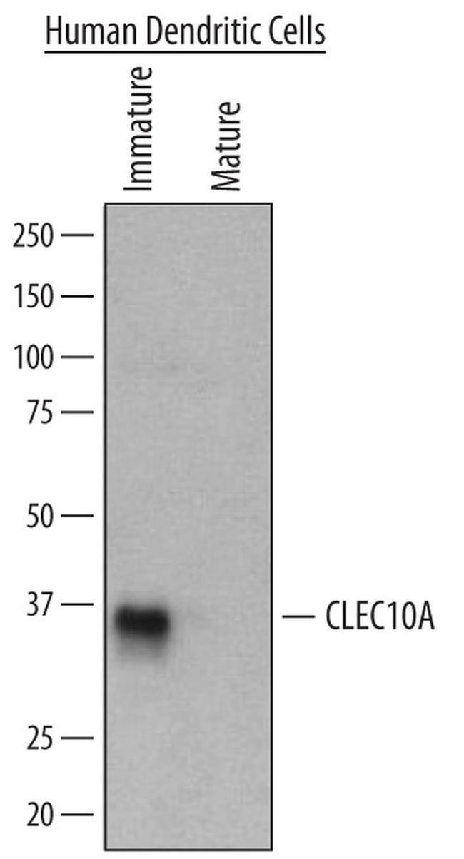 CD301 Antibody in Western Blot (WB)