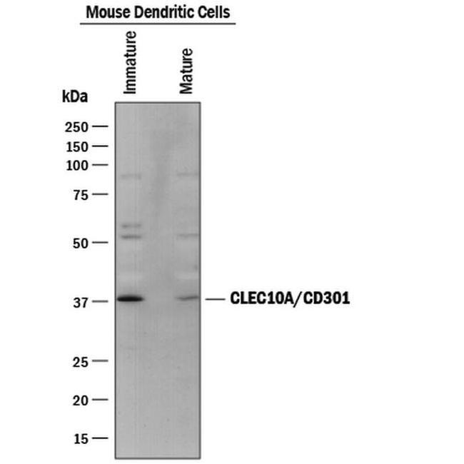 CD301 Antibody in Western Blot (WB)