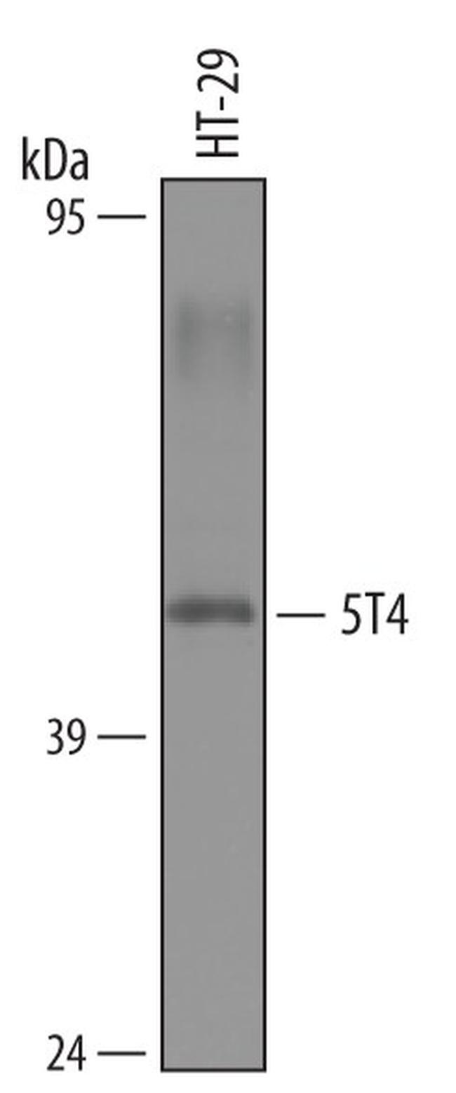 5T4 Antibody in Western Blot (WB)