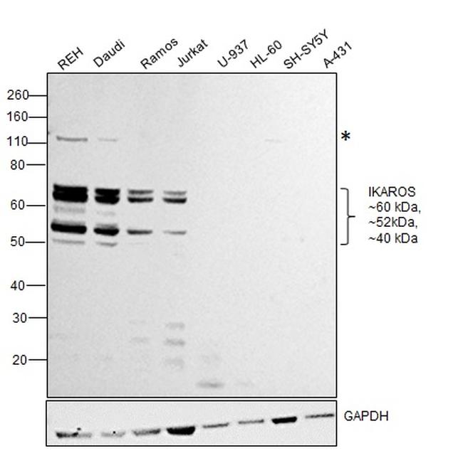 IKAROS Antibody in Western Blot (WB)