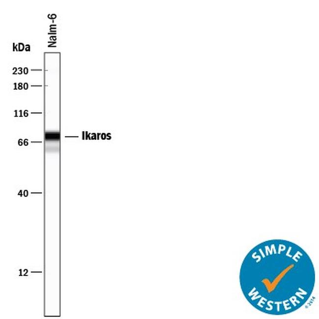 IKAROS Antibody in Western Blot (WB)