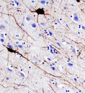 Parvalbumin Antibody in Immunohistochemistry (Paraffin) (IHC (P))