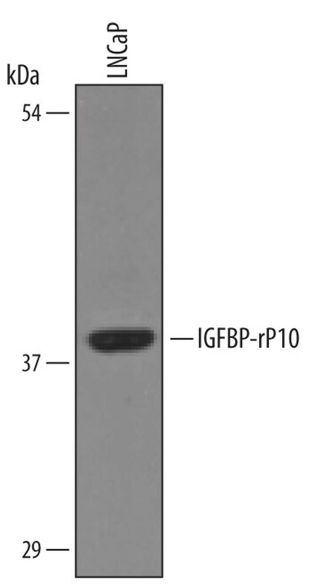 KAZALD1 Antibody in Western Blot (WB)