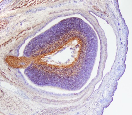 CD100 Antibody in Immunohistochemistry (Frozen) (IHC (F))