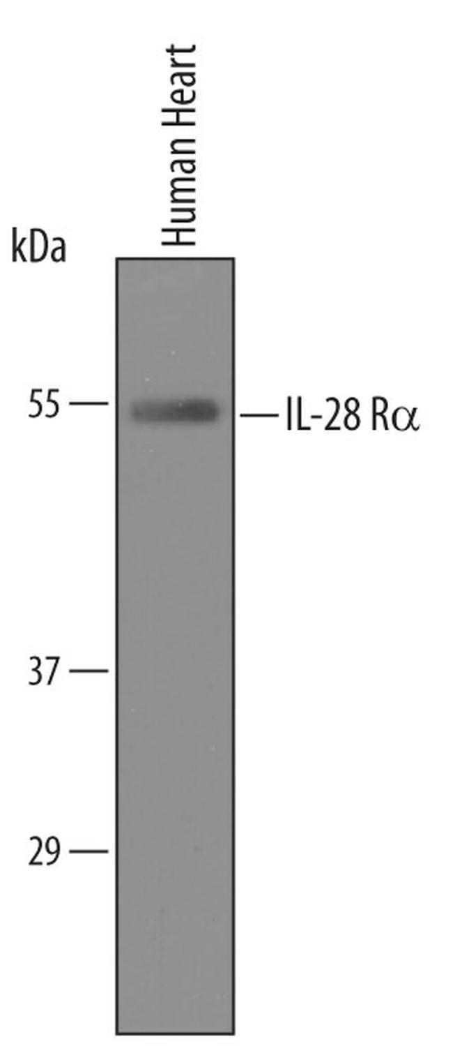 IFNLR1 Antibody in Western Blot (WB)