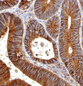 PLXNB2 Antibody in Immunohistochemistry (Paraffin) (IHC (P))