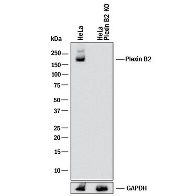 PLXNB2 Antibody in Western Blot (WB)