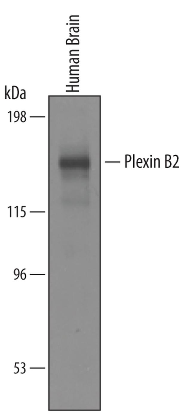 PLXNB2 Antibody in Western Blot (WB)