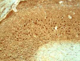 CX3CL1 Antibody in Immunohistochemistry (Frozen) (IHC (F))