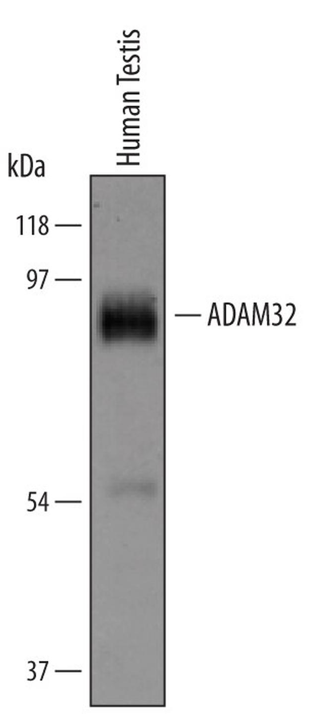 ADAM32 Antibody in Western Blot (WB)