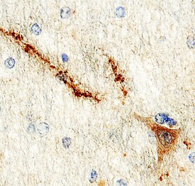 NPDC1 Antibody in Immunohistochemistry (Paraffin) (IHC (P))