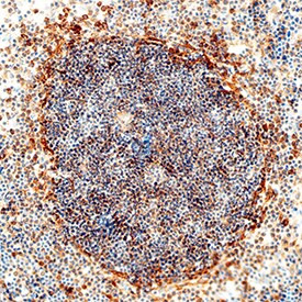 IL1R2 Antibody in Immunohistochemistry (Frozen) (IHC (F))