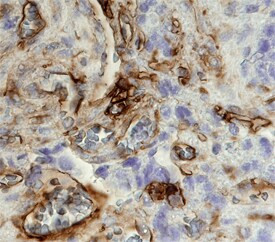 CD49a Antibody in Immunohistochemistry (Paraffin) (IHC (P))