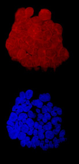 FOLR2 Antibody in Immunocytochemistry (ICC/IF)